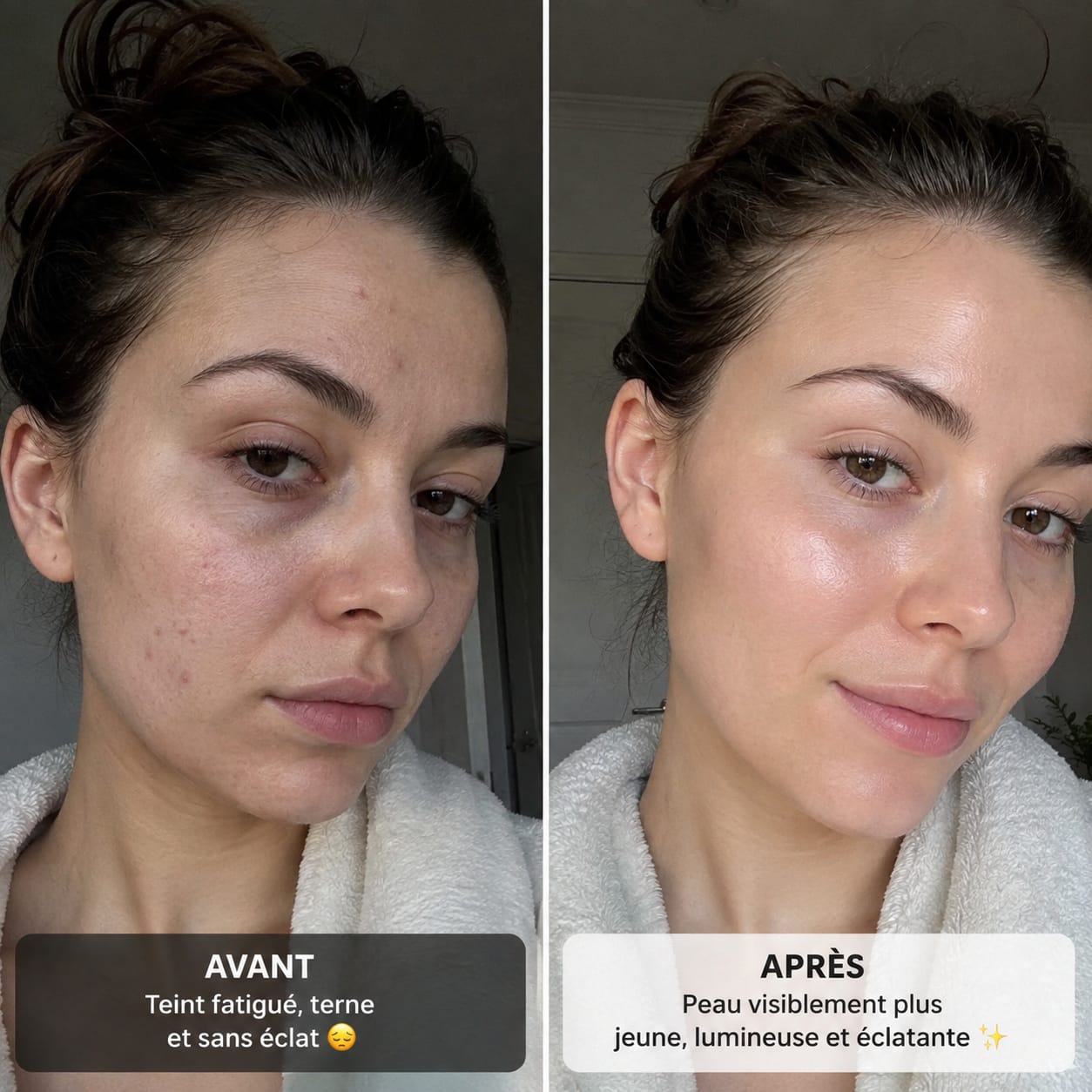 Avant / Après NOURIYA — témoignage