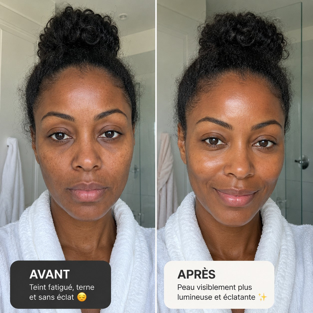 Avant / Après NOURIYA — témoignage
