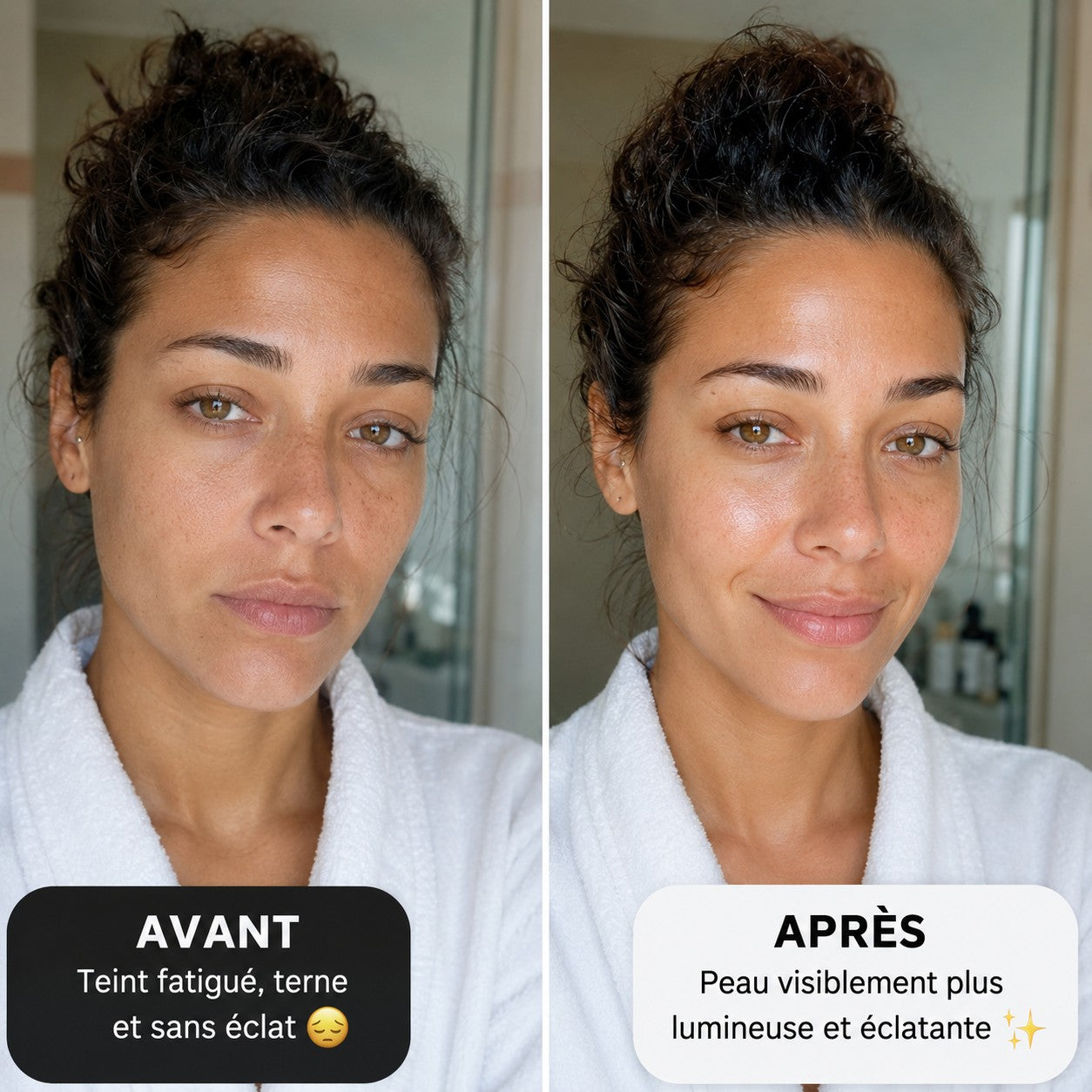 Avant / Après NOURIYA — témoignage